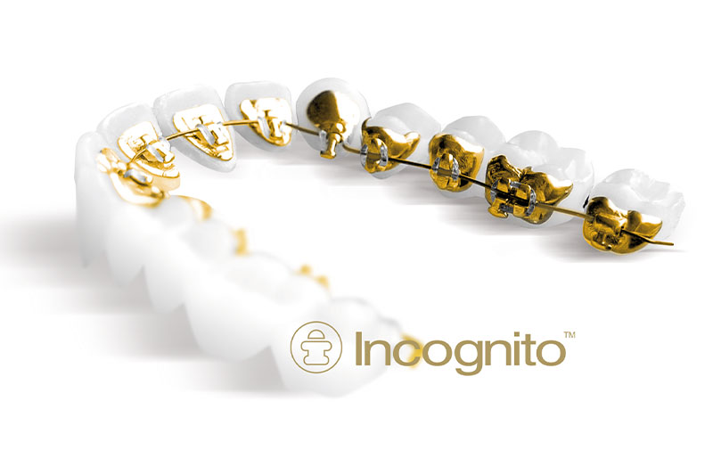 女性の矯正歯科認定医